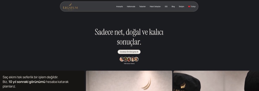 Legatum Hair web sitesi tasarımı — Saç Ekimi