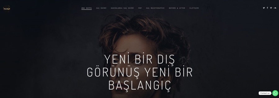 May Hair Center web sitesi tasarımı — Saç Ekimi